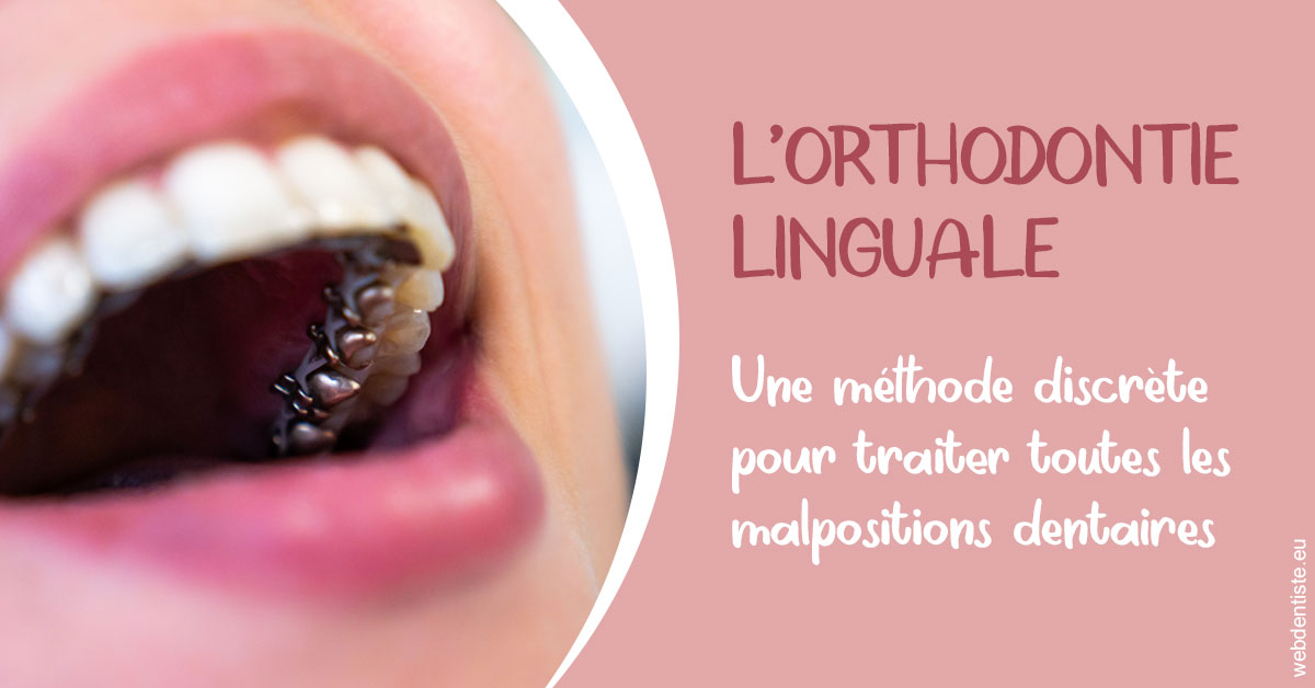 https://dr-dondoglio-virginie.chirurgiens-dentistes.fr/L'orthodontie linguale 2