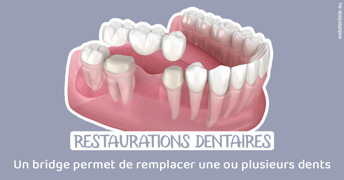 https://dr-dondoglio-virginie.chirurgiens-dentistes.fr/Bridge remplacer dents 1