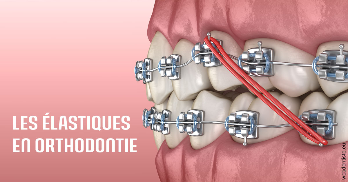 https://dr-dondoglio-virginie.chirurgiens-dentistes.fr/Elastiques orthodontie 2